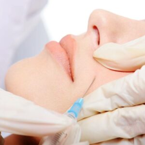 non-invasive treatments for smile lines Los Angeles 