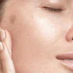 What causes uneven skin tone Los Angeles 1