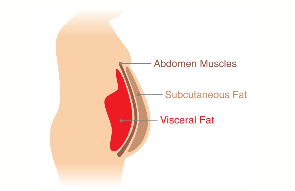 Types of belly fat