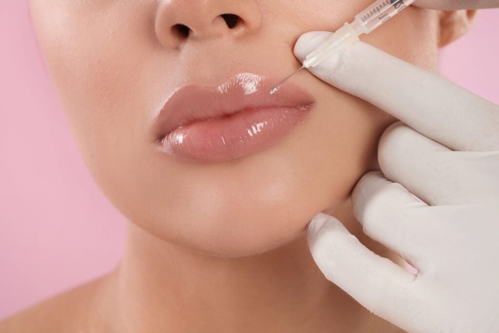 Natural-looking lip enhancements with lip fillers Los Angeles