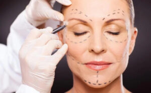 anti-wrinkles treatments Los Angeles 