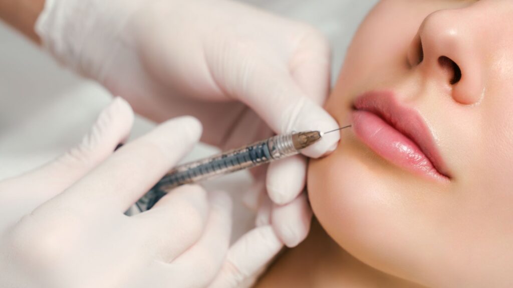 lip filler injections Los Angeles