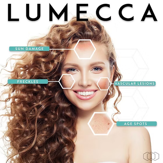 Lumecca IPL skin rejuvenation treatment Los Angeles