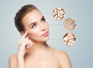 Diamond Glow for skin dryness